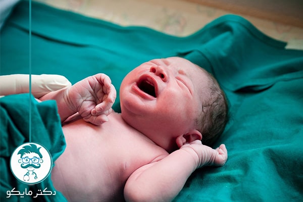 چه مادرانی باید عمل سزارین را انجام دهند؟
