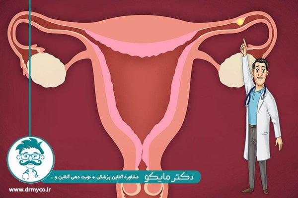 تصویر حاملگی خارج از رحم