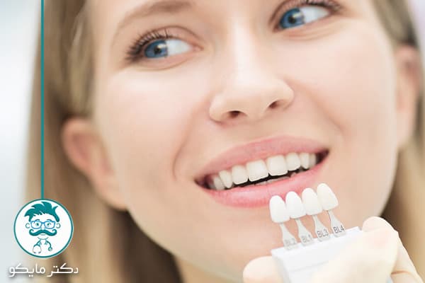 مزایای لمینت دندان
