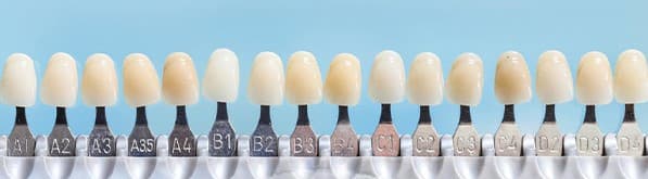 ماندگاری رنگ لمینت دندان