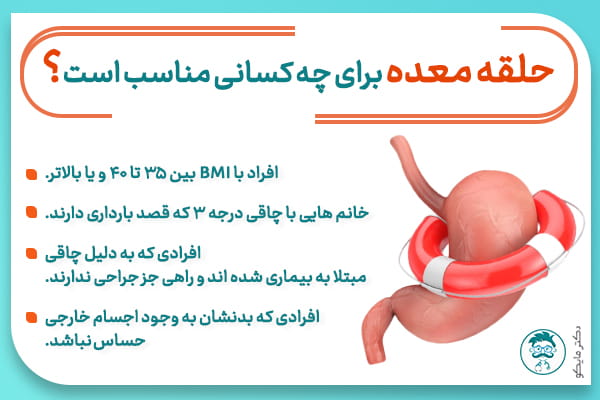 كوچك كردن معده با حلقه برای چه کسانی مناسب است؟
