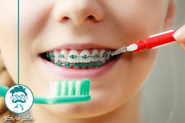 مسواک سیم کشی دندان