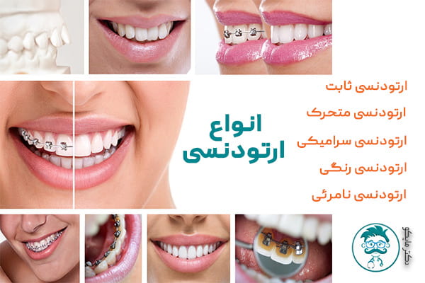 انواع ارتودنسی دندان چیست؟