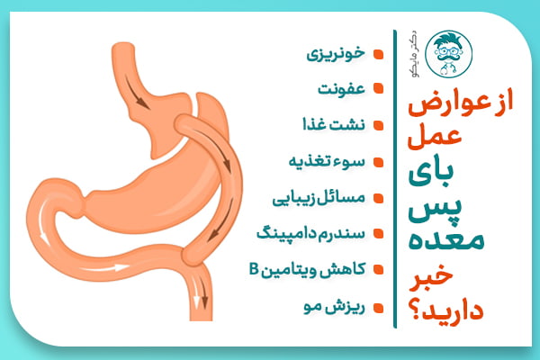 آیا بای‌پس معده عوارض دارد+چه آمپولی برای لاغری خوب است+آیا بالون معده عوارض دارد+نظرات درباره بالون معده