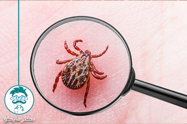 شیوع بیماری لایم در ایران
