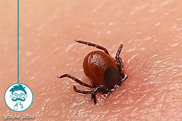 روش تشخیص بیماری لایم و درمان