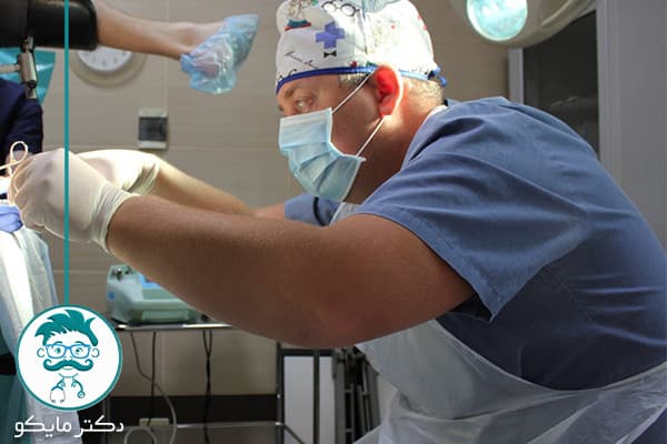 انواع عمل بواسیر