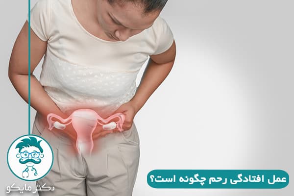 عمل افتادگی رحم 