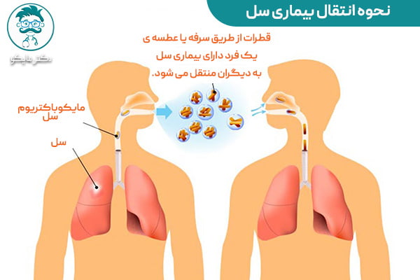 بیماری ریوی سل 
