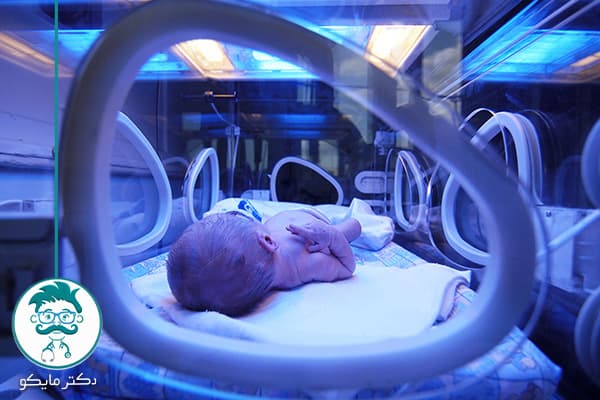 نحوه­ ی شیر دادن به نوزاد زیر دستگاه زردی