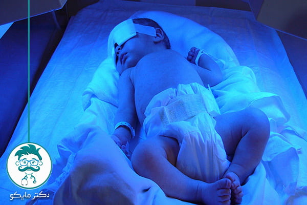 زردی نوزاد چقدر طول می‌کشد؟