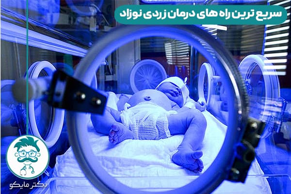 راه های درمان زردی نوزاد چیست؟