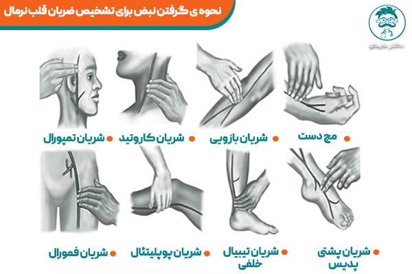 گرفتن نبض برای تشخیص ضربان قلب نرمال