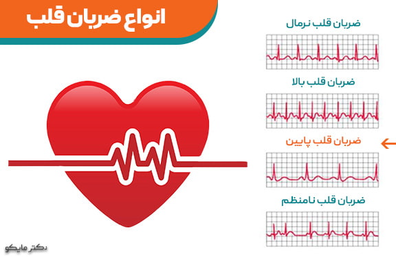آیا ضربان پایین قلب خطرناک است؟