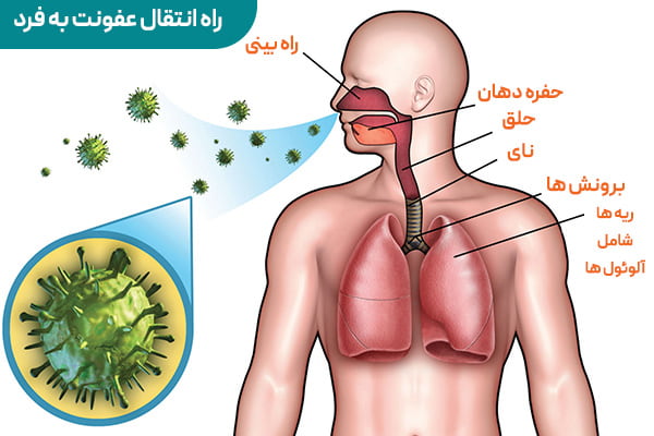 بهترین داروی عفونت ریوی: برای عفونت ریه چه قرصی بهتر است؟