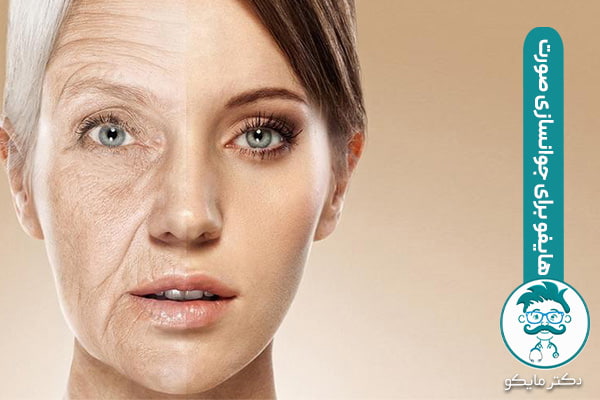 مدت ماندگاری تاثیر هایفو صورت چقدر است؟