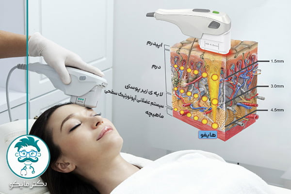 آیا هایفوتراپی درد دارد؟