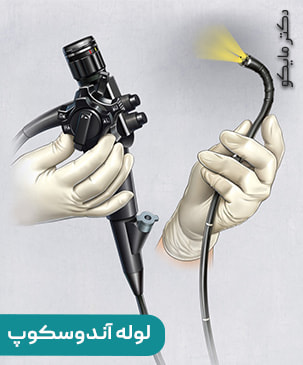 برای درد بعد از آندوسکوپی چه کنیم؟