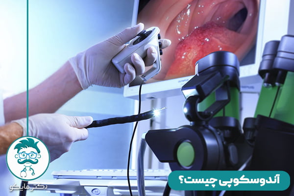 آندوسکوپی چیست 