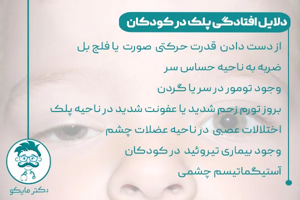 دلایل افتادگی پلک در کودکان