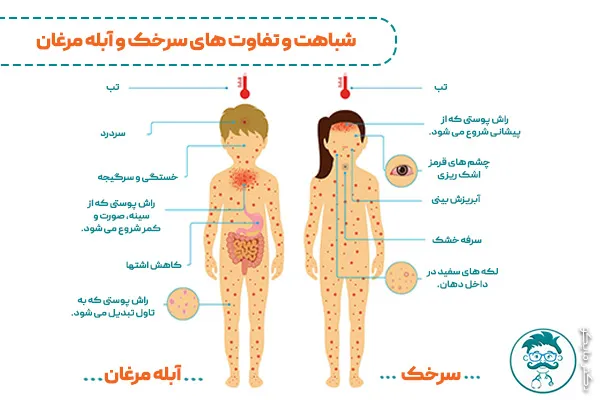 تفاوت سرخک و آبله مرغان