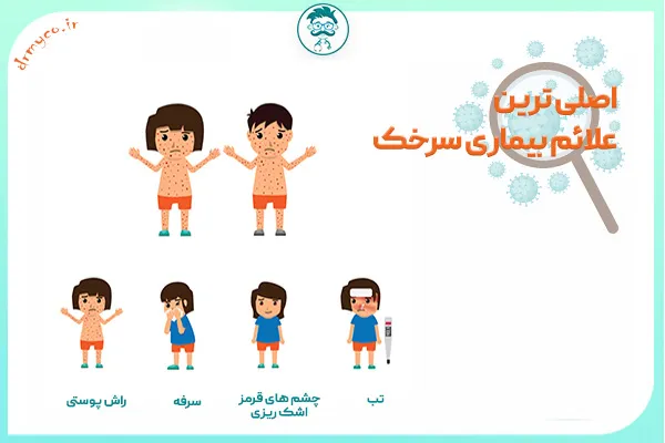 شایع ترین علائم سرخک 