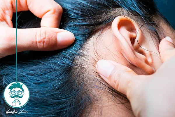 چوب درخت چریش برای درمان شپش سر