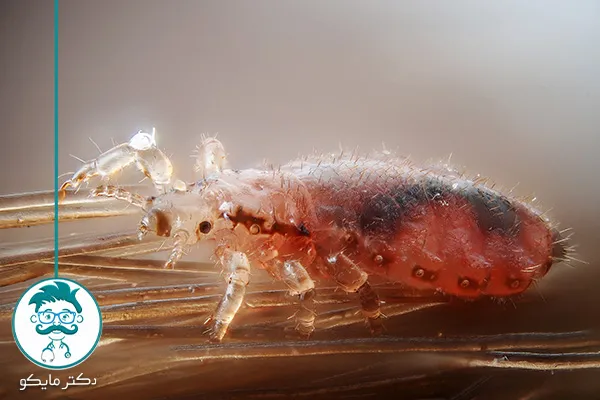 درمان رشک سر با اسپند