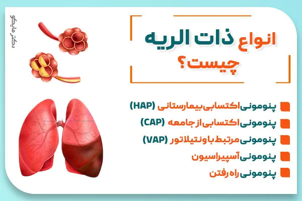 انواع پنومونی چیست؟