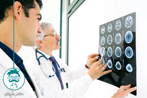 درمان ام اس