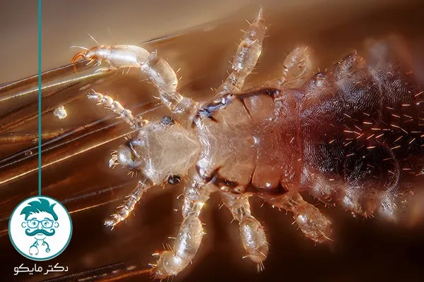 شپش سر یا رشک