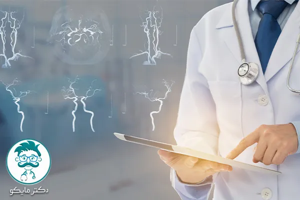 دکتر خوب برای سکته مغزی