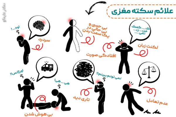 علائم سکته مغزی شدید 