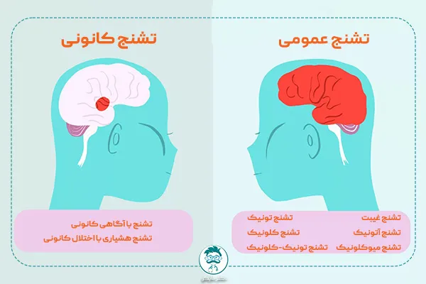 انواع تشنج در صرع