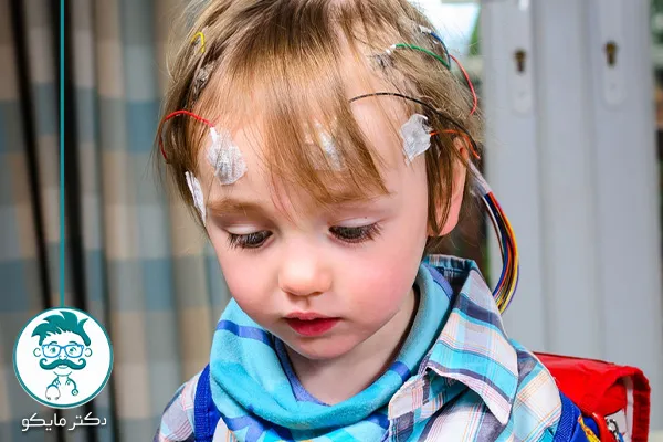 بیماری صرع در کودکان