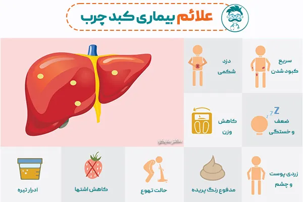 علائم بیماری کبد چرب چیست؟ مدت درمان، مراحل و علت -دکترمایکو