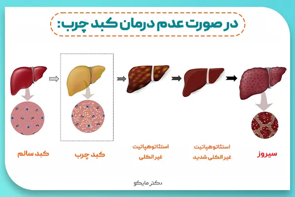 خطرات بیماری کبد چرب