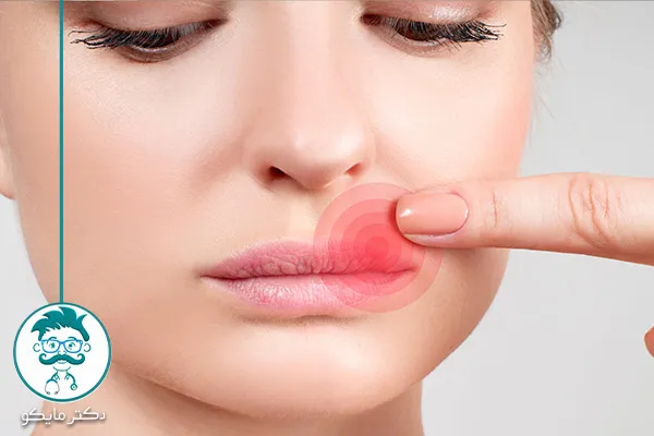 درمان های خانگی تبخال لب