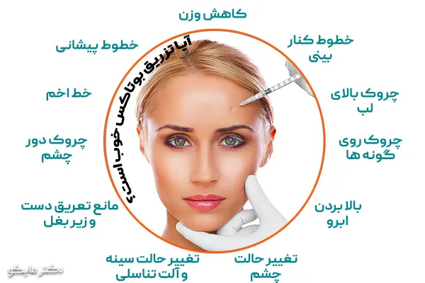 تزریق بوتاکس خوب است؟
