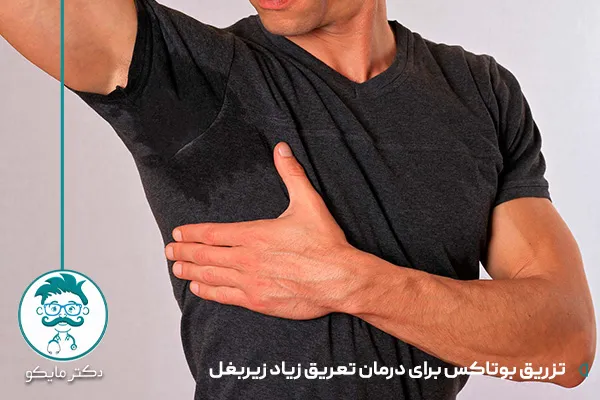 بوتاکس زیر بغل
