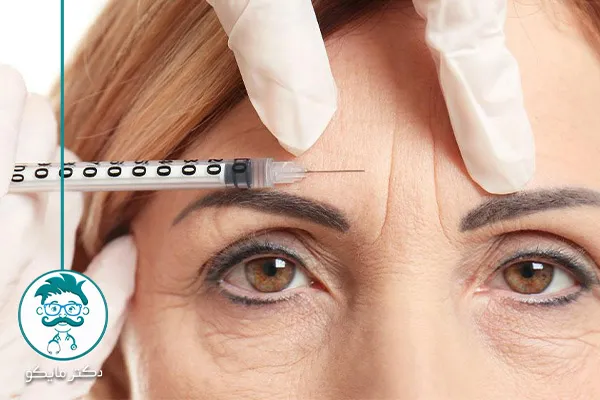 بوتاکس پیشانی 