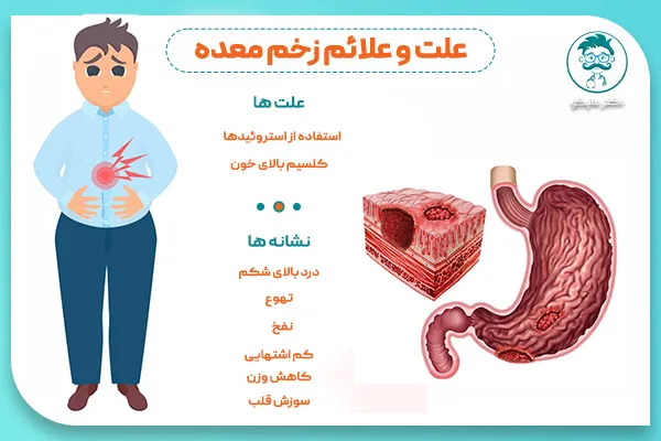 درد اثنی عشر / زخم دوازدهه / زخم دئودنوم کجاست؟