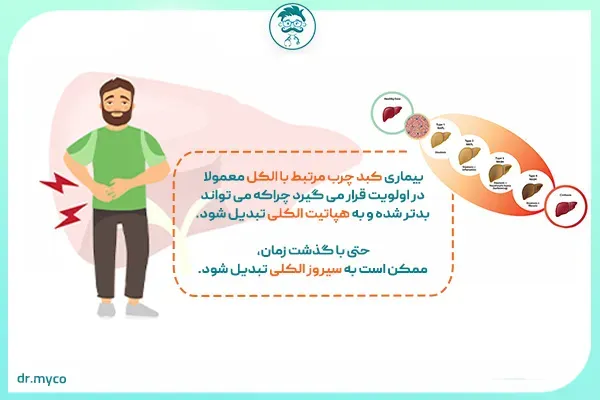 اولویت درمان کبد چرب