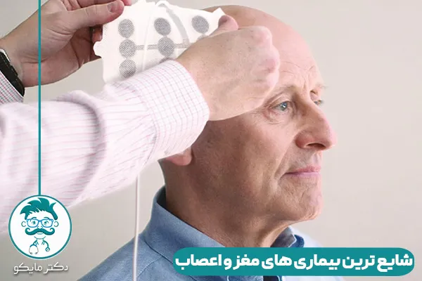 بیماری های مغز و اعصاب