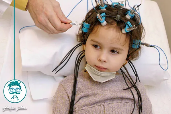 درمان بیماری مغز و اعصاب 