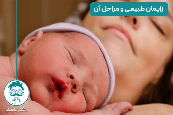 زایمان طبیعی و مراحل آن