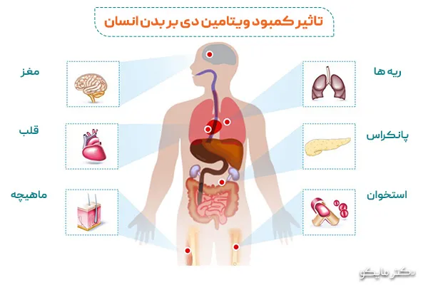 تاثیر کمبود ویتامین دی بر بخش های مختلف بدن
