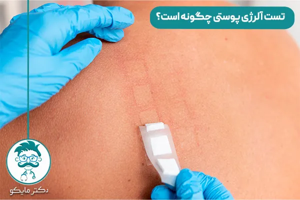 تست آلرژی چیست؟