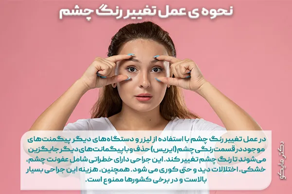 عمل تغییر رنگ چشم