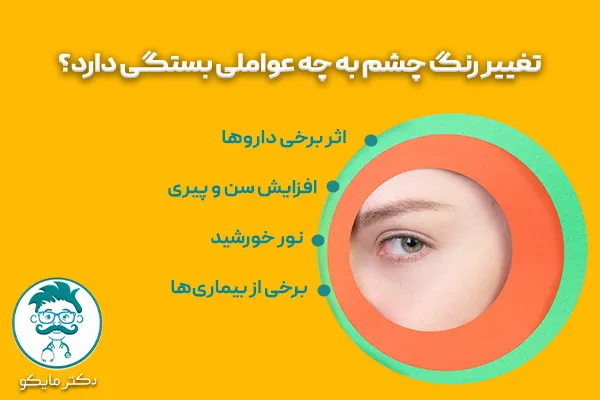 علت تغییر رنگ چشم چیست؟